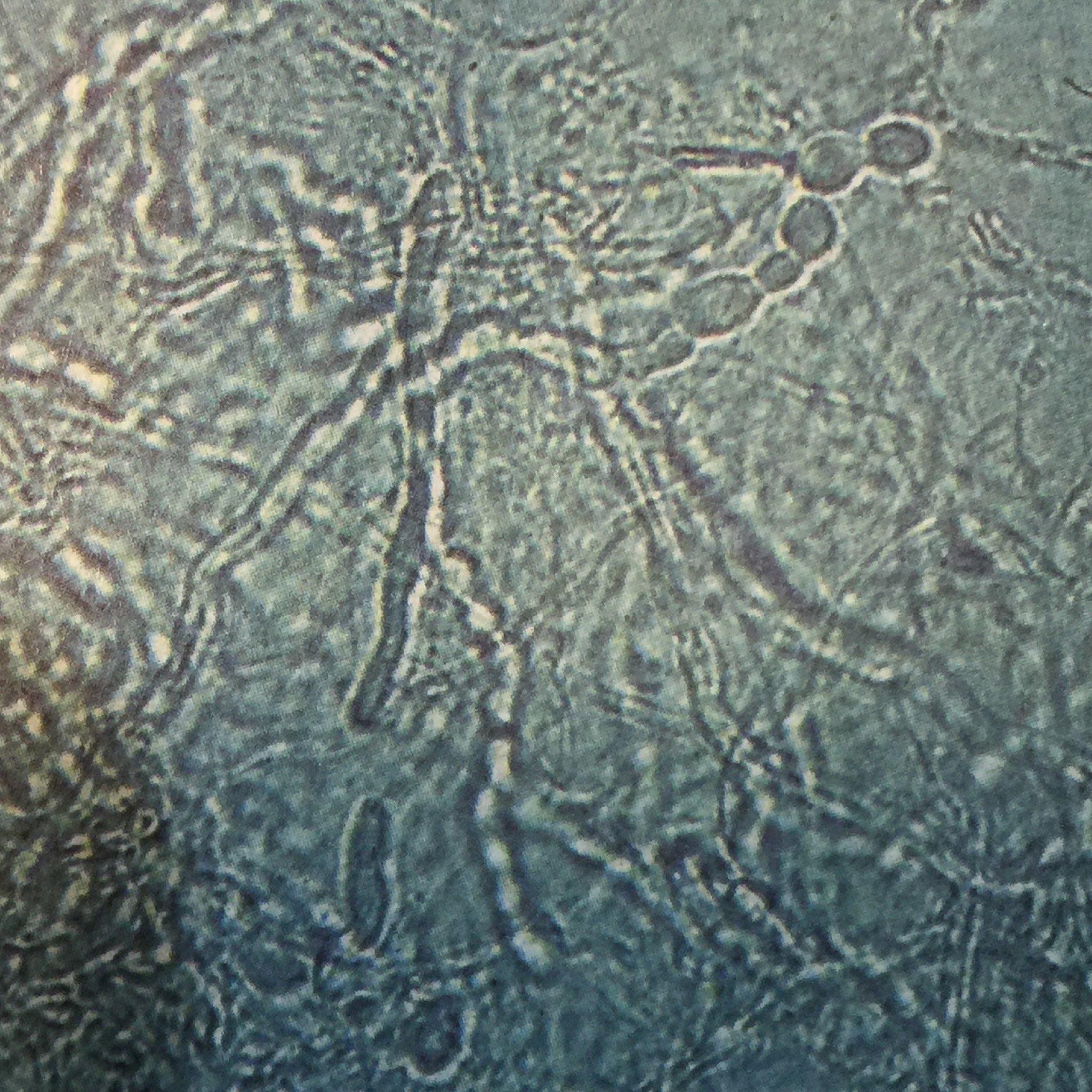 顕微鏡で診た白癬菌（はくせんきん）